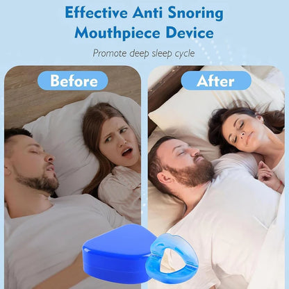 Anti-Snore Mouth Piece